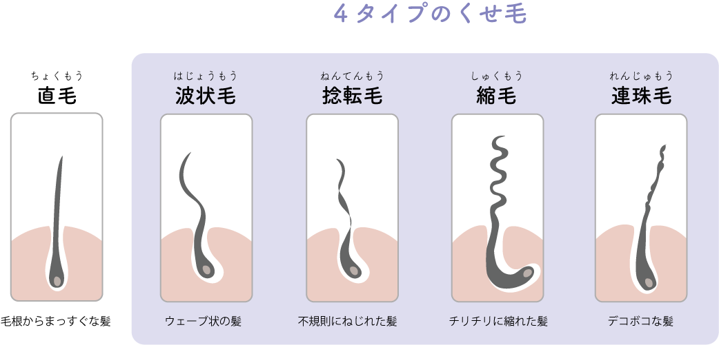 くせ毛のタイプ@2x-8.png