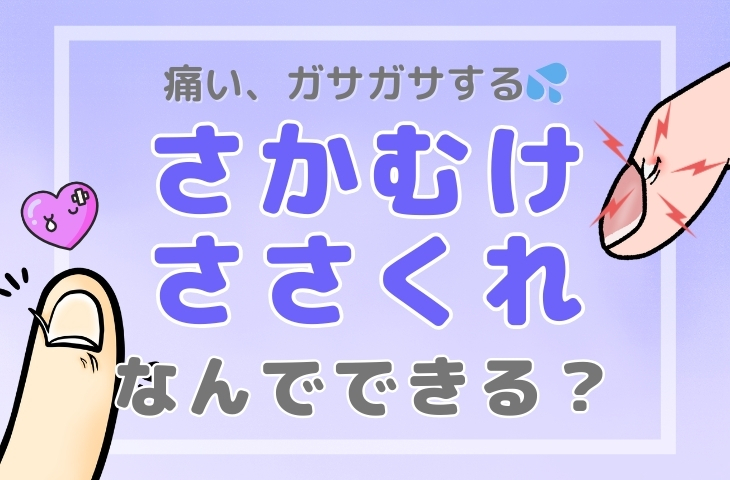 さかむけ（ささくれ）なんでできる？