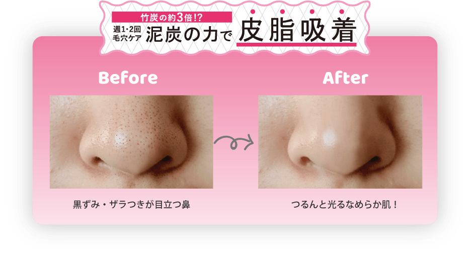 竹炭の約３倍？週１、２回の毛穴ケア。泥炭の力で皮脂吸着