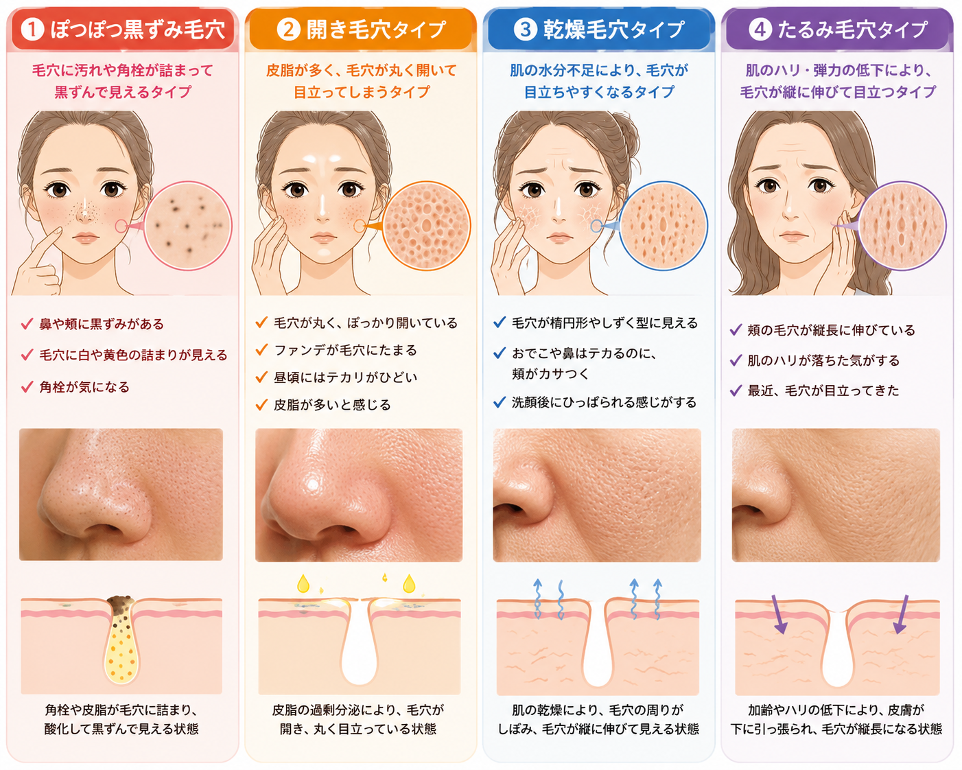毛穴４タイプ